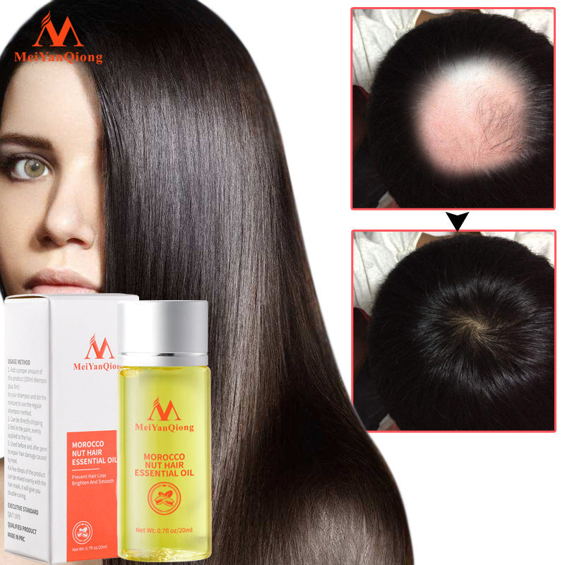 Beauty Qiong Hair Growth Nut Essential Oil for Hair Care A&S Collection