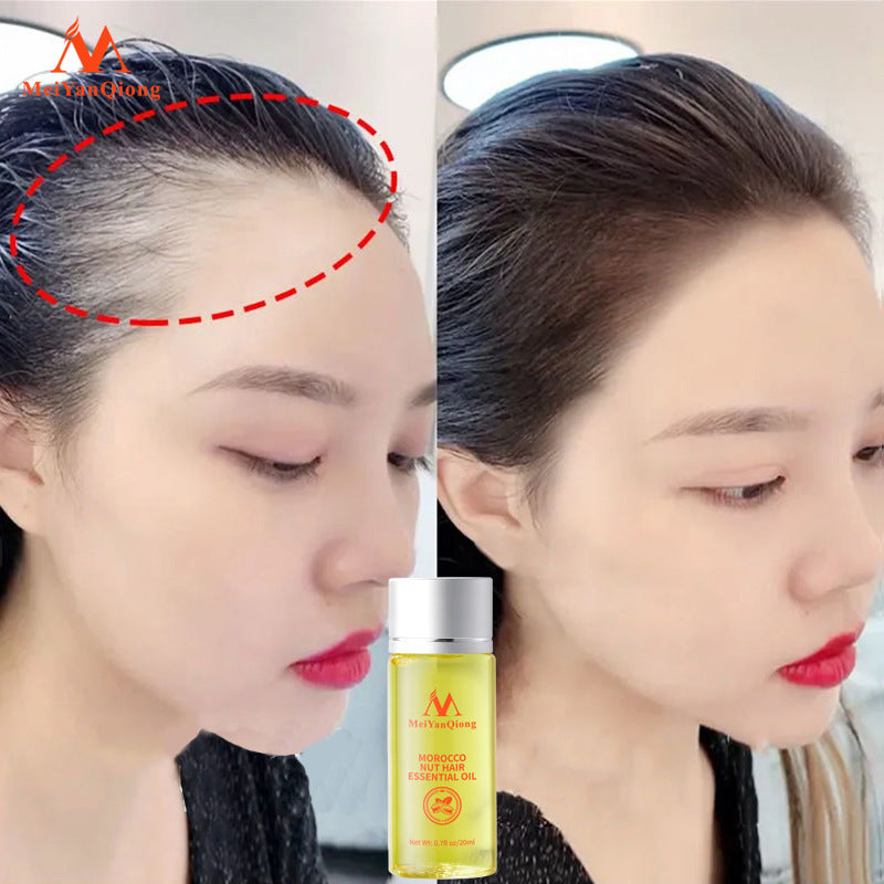Beauty Qiong Hair Growth Nut Essential Oil for Hair Care A&S Collection