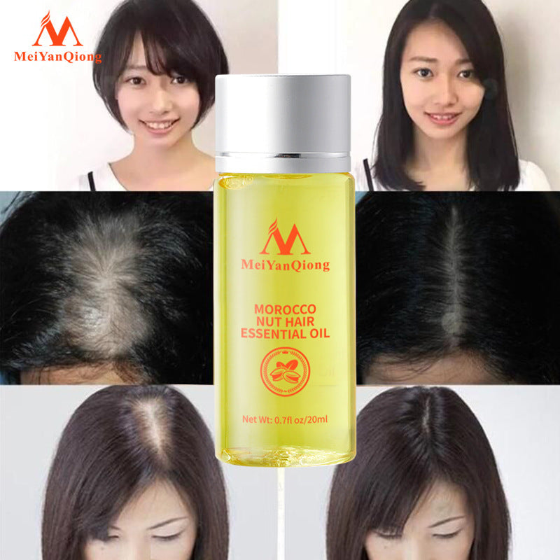 Beauty Qiong Hair Growth Nut Essential Oil for Hair Care A&S Collection