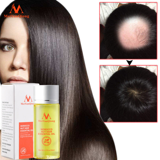 Beauty Qiong Hair Growth Nut Essential Oil for Hair Care A&S Collection